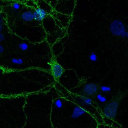 A role for cell ‘antennae’ in managing dopamine signals in the brain