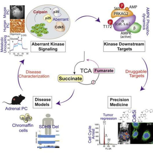 New understanding of how faulty metabolism triggers adrenal cancer