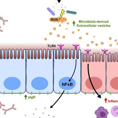 Uncovering the links between diet, gut health and immunity