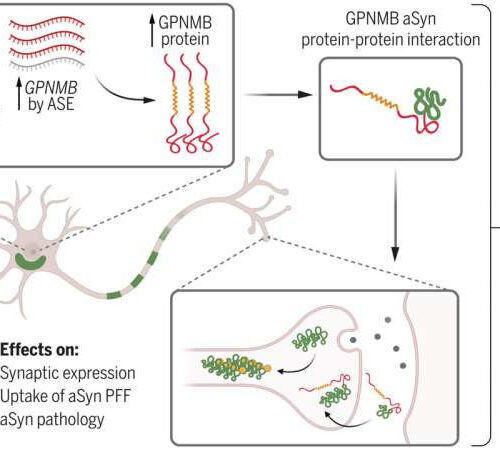 Increased concentrations of GPNMB in blood samples could be biomarker for Parkinson’s disease