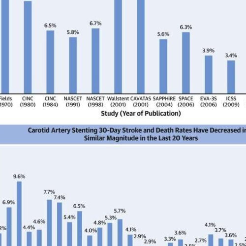 New study makes case for expanding coverage for carotid artery stenting