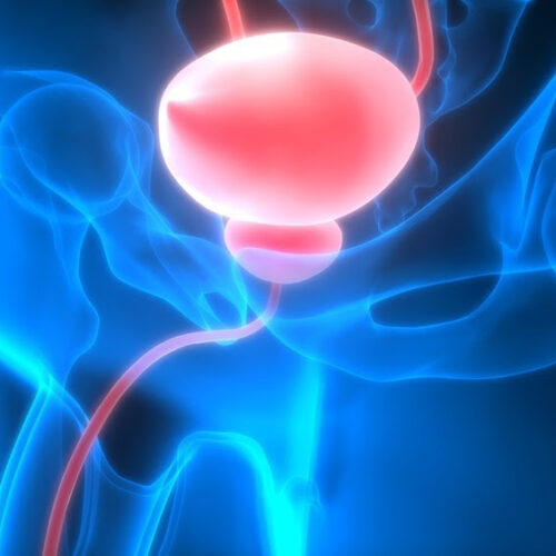 What is Bladder Exstrophy-Epispadias-Cloacal Exstrophy Complex?