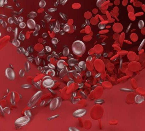 Severe COVID-19 increases risk of life-threatening blood clots