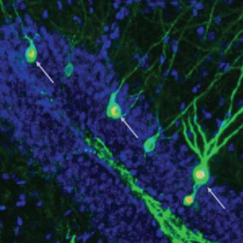 Boosting neuron formation restores memory in mice with Alzheimer’s disease
