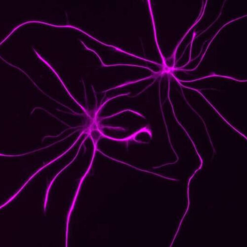 Beyond neurons: How cells called astrocytes contribute to brain disorders