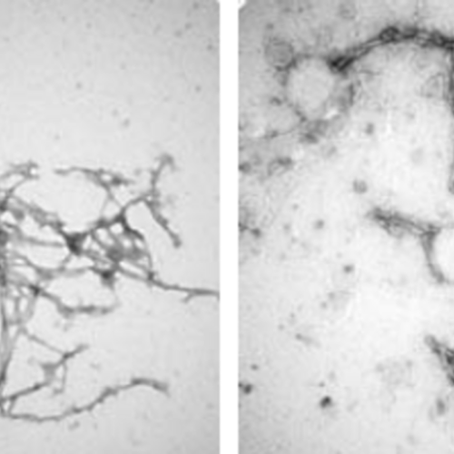 Nanobody treatment could help clear brain protein clumps in Parkinson’s