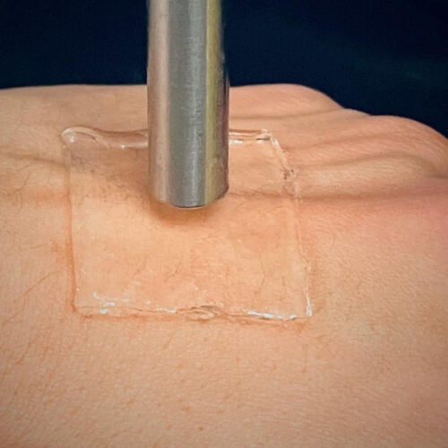 Hydrogel bandage uses ultrasound to better stick to the skin