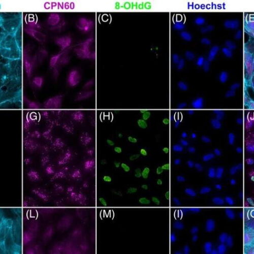 New gene therapy shows promise for treating age related macular degeneration