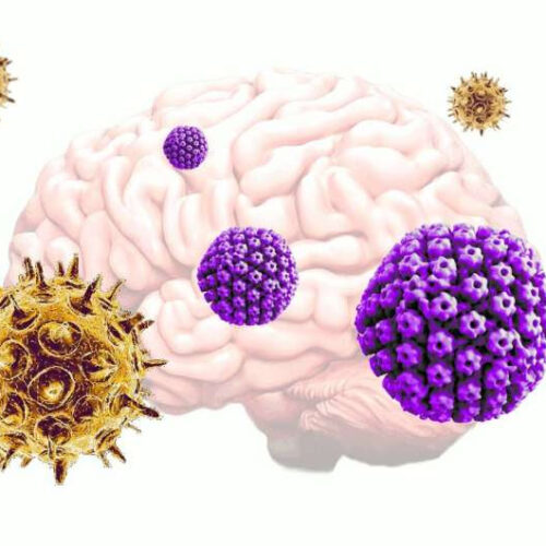 Common viruses may be triggering the onset of Alzheimer’s disease