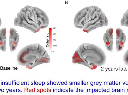 Children who lack sleep may experience detrimental impact on brain and cognitive development that persists over time