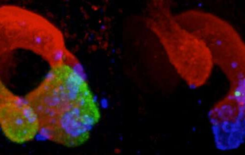 Researchers show how mutations in ‘dark genome’ cause pancreatic malformations