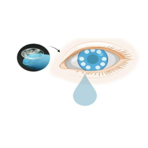 Smart contact lenses for cancer diagnostics and screening