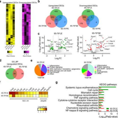 Pathway uncovered for greatest lupus genetic risk factor, study shows