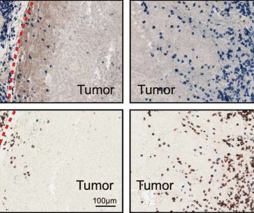 Cancer cells selectively load ‘drones’ to keep T cells from infiltrating tumors