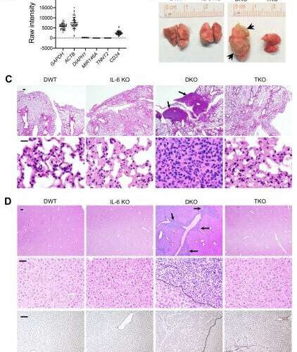 Inflammatory signaling linked to leukemia progression