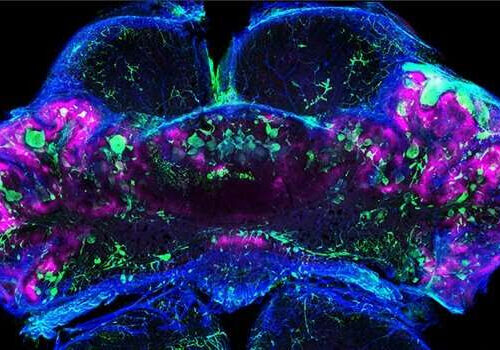 Blood clot formation in cerebral cavernous malformations