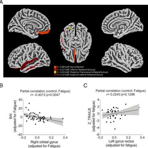 Evidence of SARS-CoV-2 virus infecting astrocyte cells in the brain