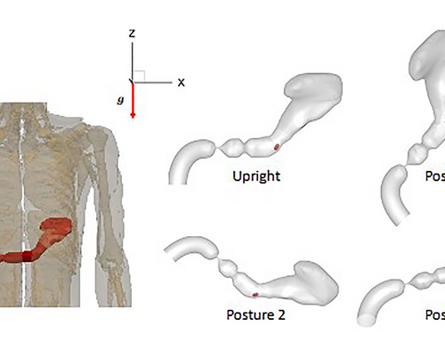 Body posture affects how oral drugs absorbed by stomach