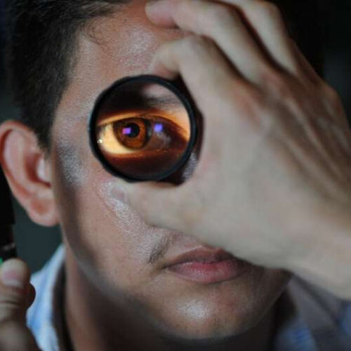 Early onset of diabetes, hypertension can predict early glaucoma, ophthalmologists report