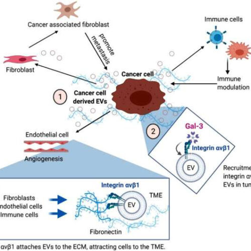 Proteins in cell-based particles could lead to early diagnosis and treatment of breast cancer metastasis