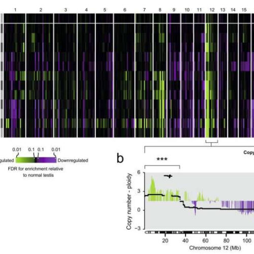 Origins of germ cell tumors suggest possible opportunities for future treatment