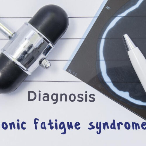 New evidence affirms link between long COVID and chronic fatigue syndrome