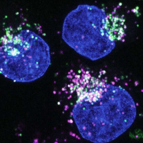 Breaking down proteins: How starving cancer cells switch food sources