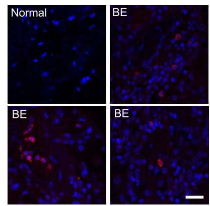 International study discovers bacteria previously thought harmless can worsen existing lung disease