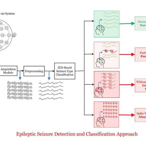 Detecting seizures and interpreting EEGs, the direct algorithmic way