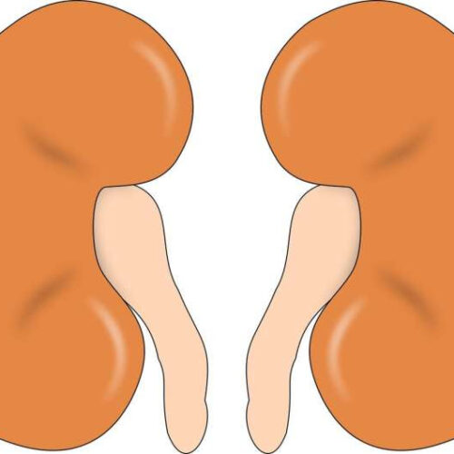 Three-drug combination slows progression of advanced kidney cancer