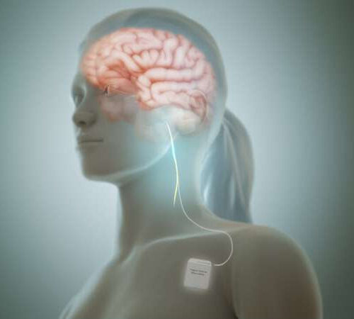 Stimulation of the vagus nerve strengthens the communication between the stomach and the brain