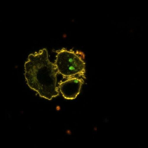 Diabetes: When circadian lipid rhythms go wrong