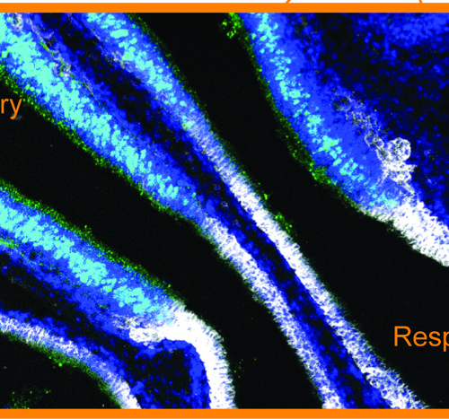 Newly discovered barrier prevents immunity from reaching smell-sensing cells