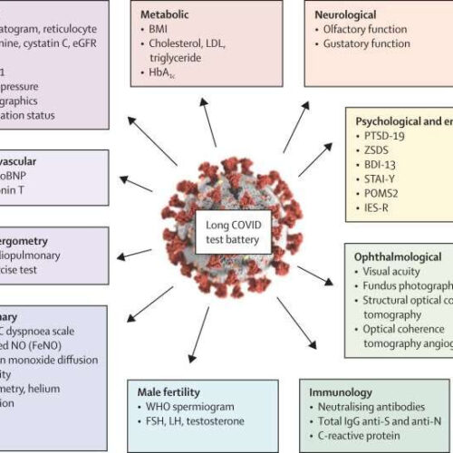 Having high cholesterol and reduced physical stamina and being overweight are long COVID sequelae in young adults