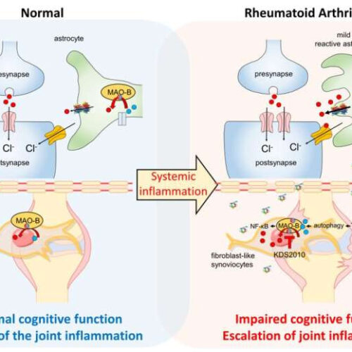Two birds one stone strategy to treat both joint pain and cognitive impairment in rheumatoid arthritis