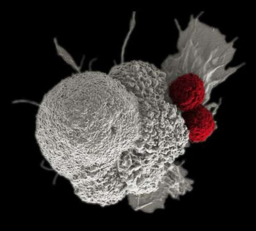 Deliberately damaging DNA could boost the effectiveness of immunotherapy in kidney cancer