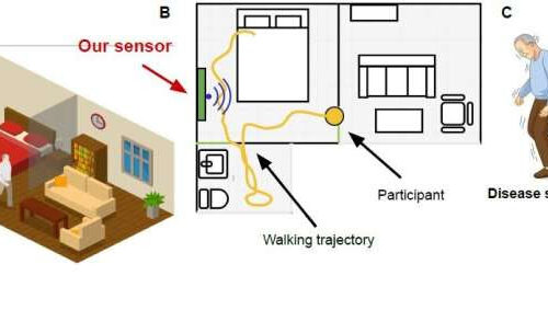 In-home wireless device tracks disease progression in Parkinson’s patients