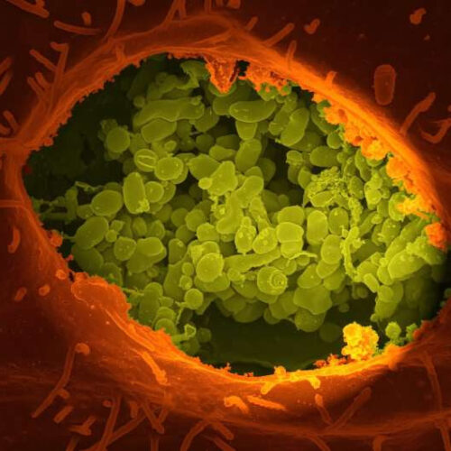 Some viruses that cause cancer suppress the immune system with help from common bacteria