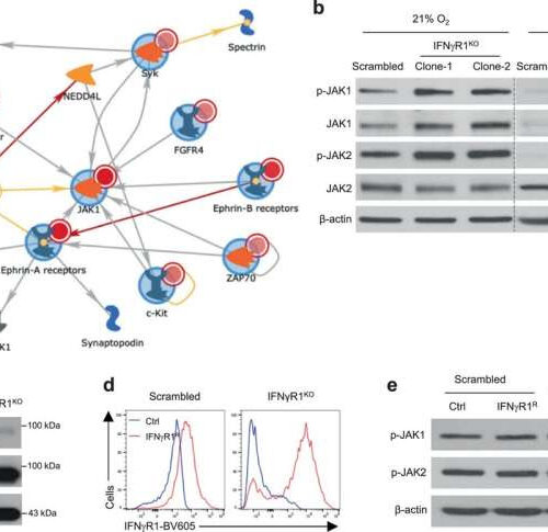 Potential melanoma target bypasses therapeutic resistance to immune checkpoint blockers