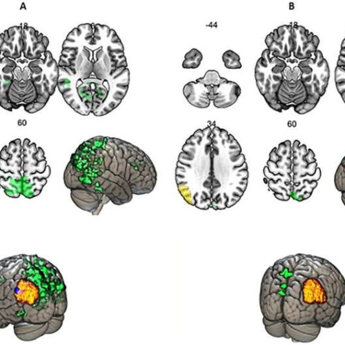 Neurolinguists report not two, but three options for brain functional categories