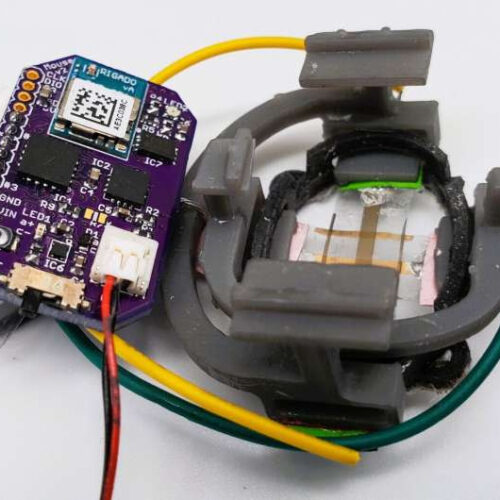 New wearable device measures the changing size of tumors below the skin