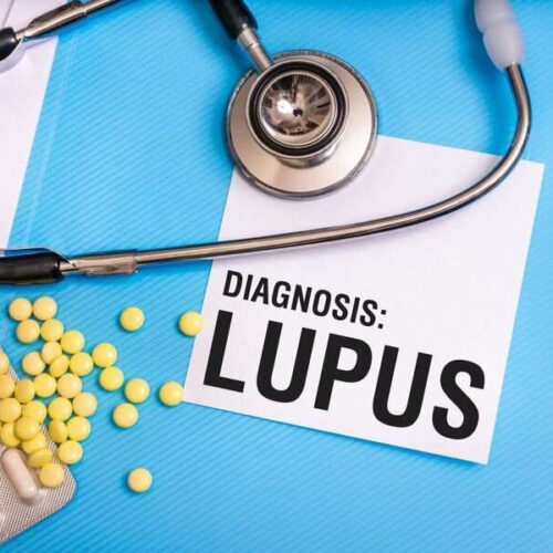 Experimental drug shows promise against lupus