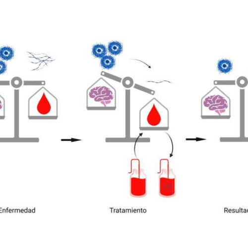 New therapeutic target could check the progress of Alzheimer’s disease