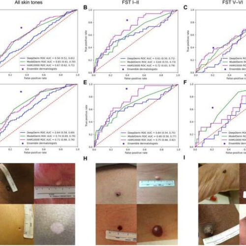 Training physicians and algorithms in dermatology diversity