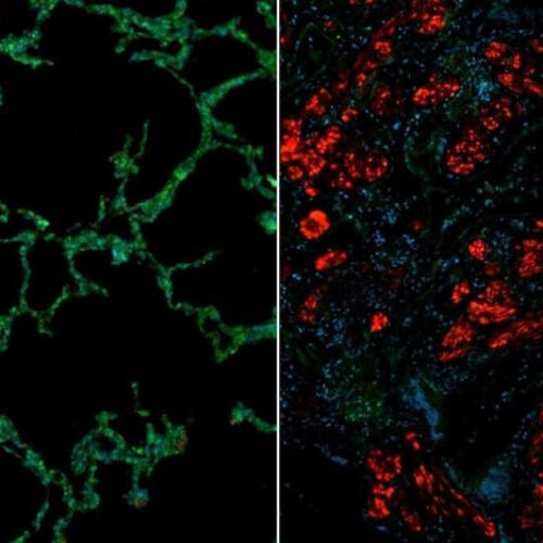 Reversing lung fibrosis in scleroderma requires an increase in antifibrotic proteins