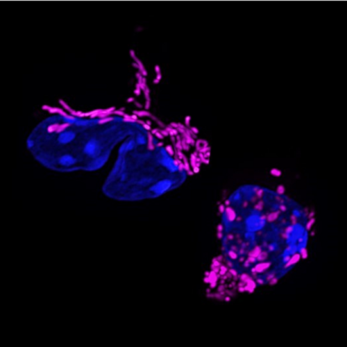 Immune function remodeled by mitochondrial shape