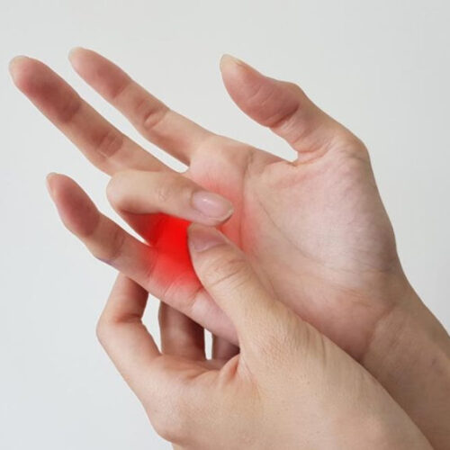 Higher A1C Levels in Diabetes Linked to Trigger Finger