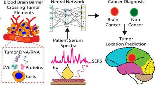 Biosensor detects brain tumors with less than a drop of blood