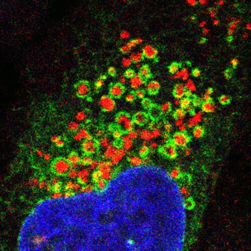 “Universal” pathway behind cell recycling offers clues to combat aging