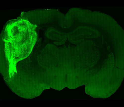 Human ‘mini-brains’ implanted in rats prompt excitement — and concern